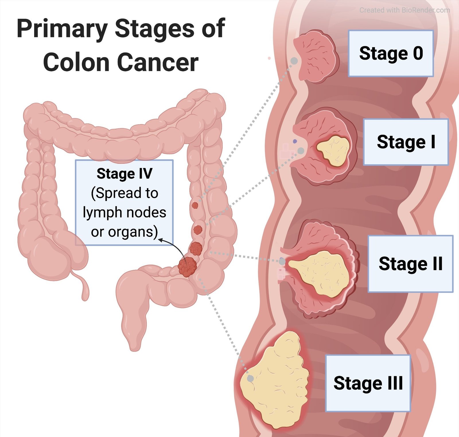 oncology cancer