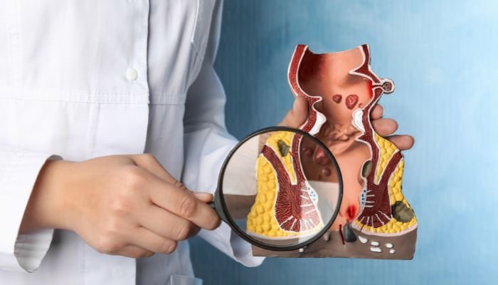 Best Doctors For Piles Fissure Treatment Near Chandkheda